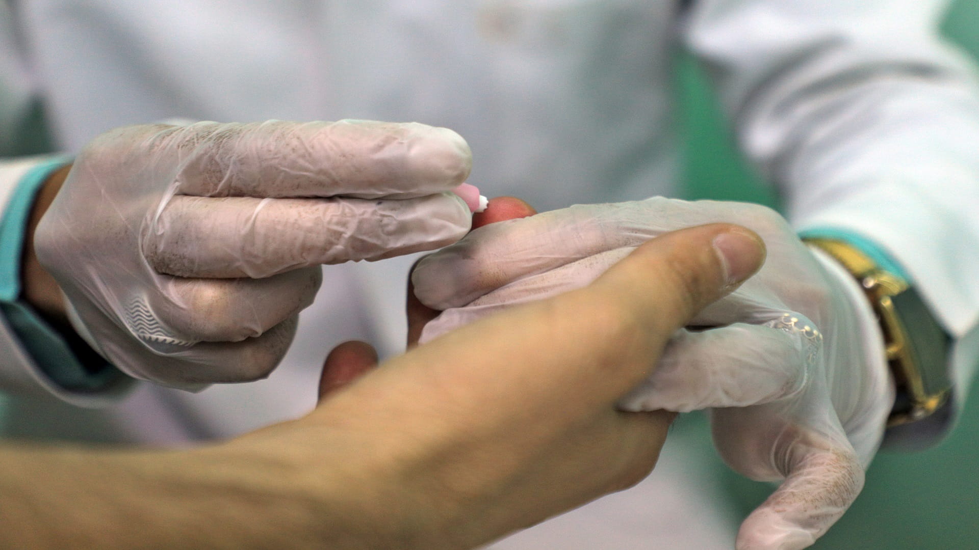 Image for the title: Blood test may accurately predict Alzheimer's: study 