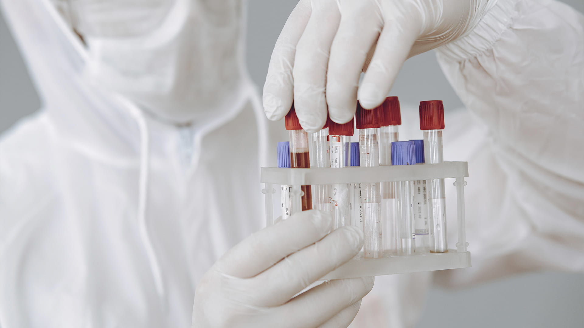 صورة بعنوان: اضطراب انخفاض الصفائح الدموية المناعي 