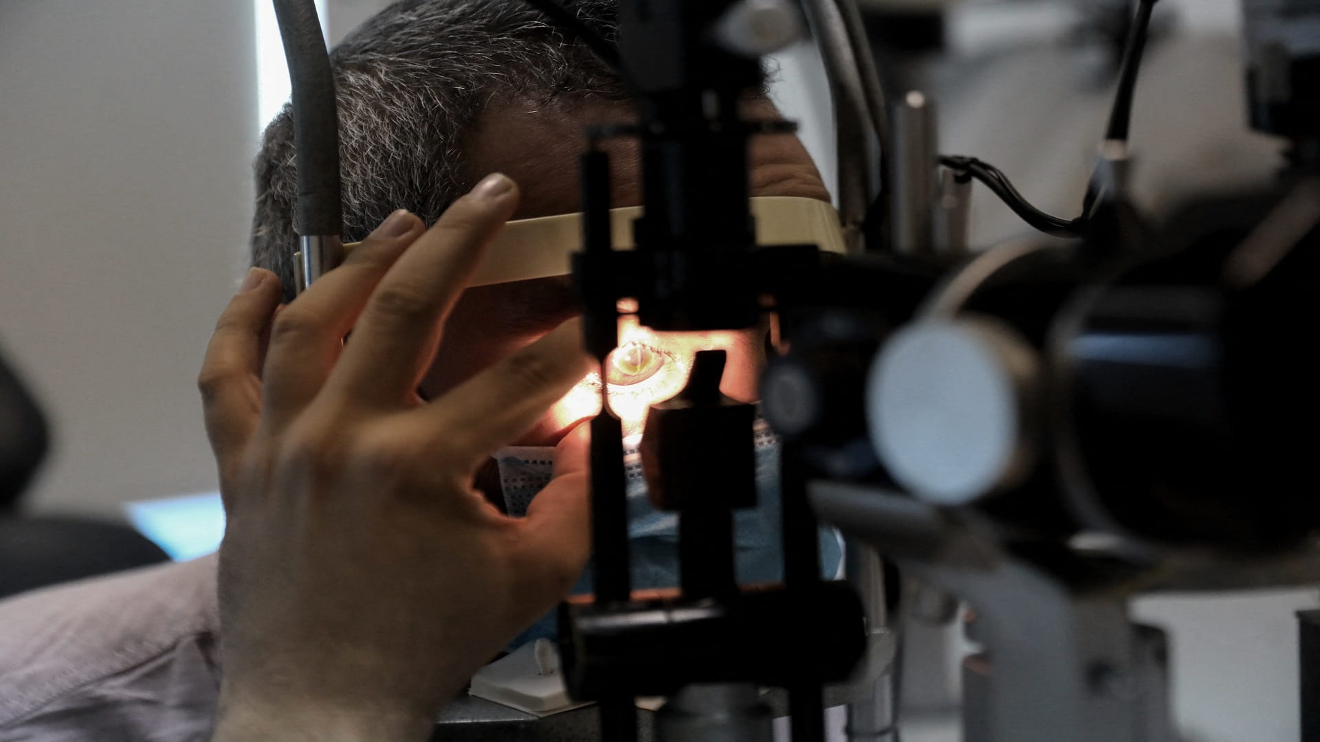 صورة بعنوان: انسداد القناة الدمعية  