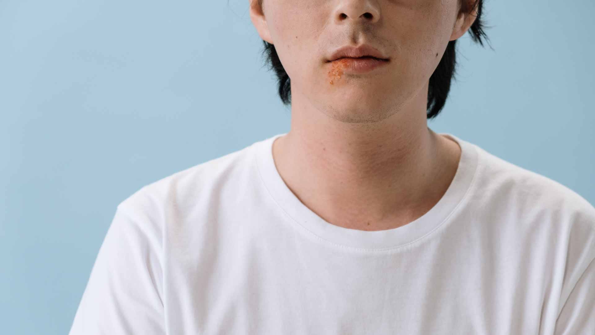 صورة بعنوان: اختبارات الحساسية عن طريق الجلد 