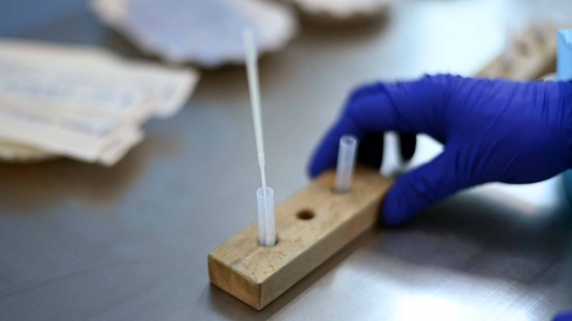 صورة بعنوان: بأمل...عقار ضد الاكتئاب يقلل الحاجة إلى الاستشفاء بين مصابي كورونا 