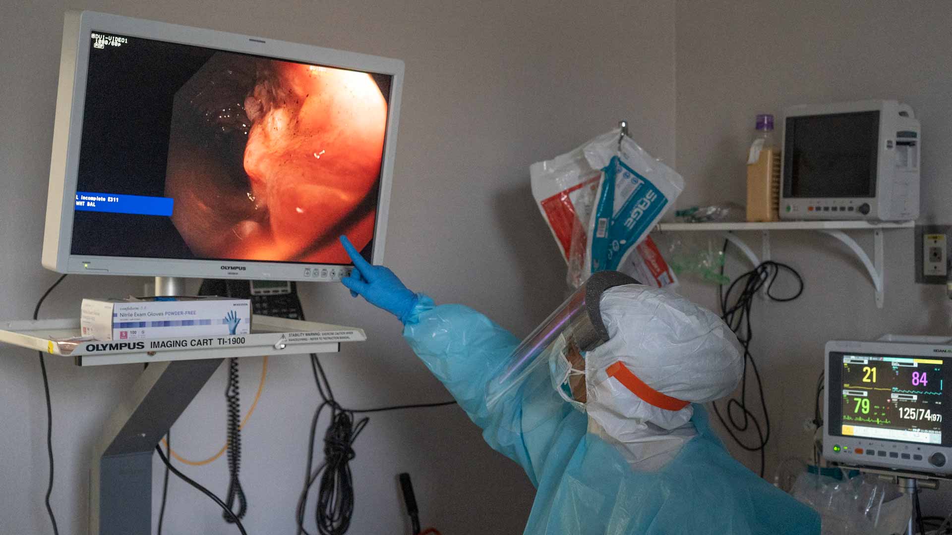 صورة بعنوان: منظار الجهاز الهضمي العلوي 