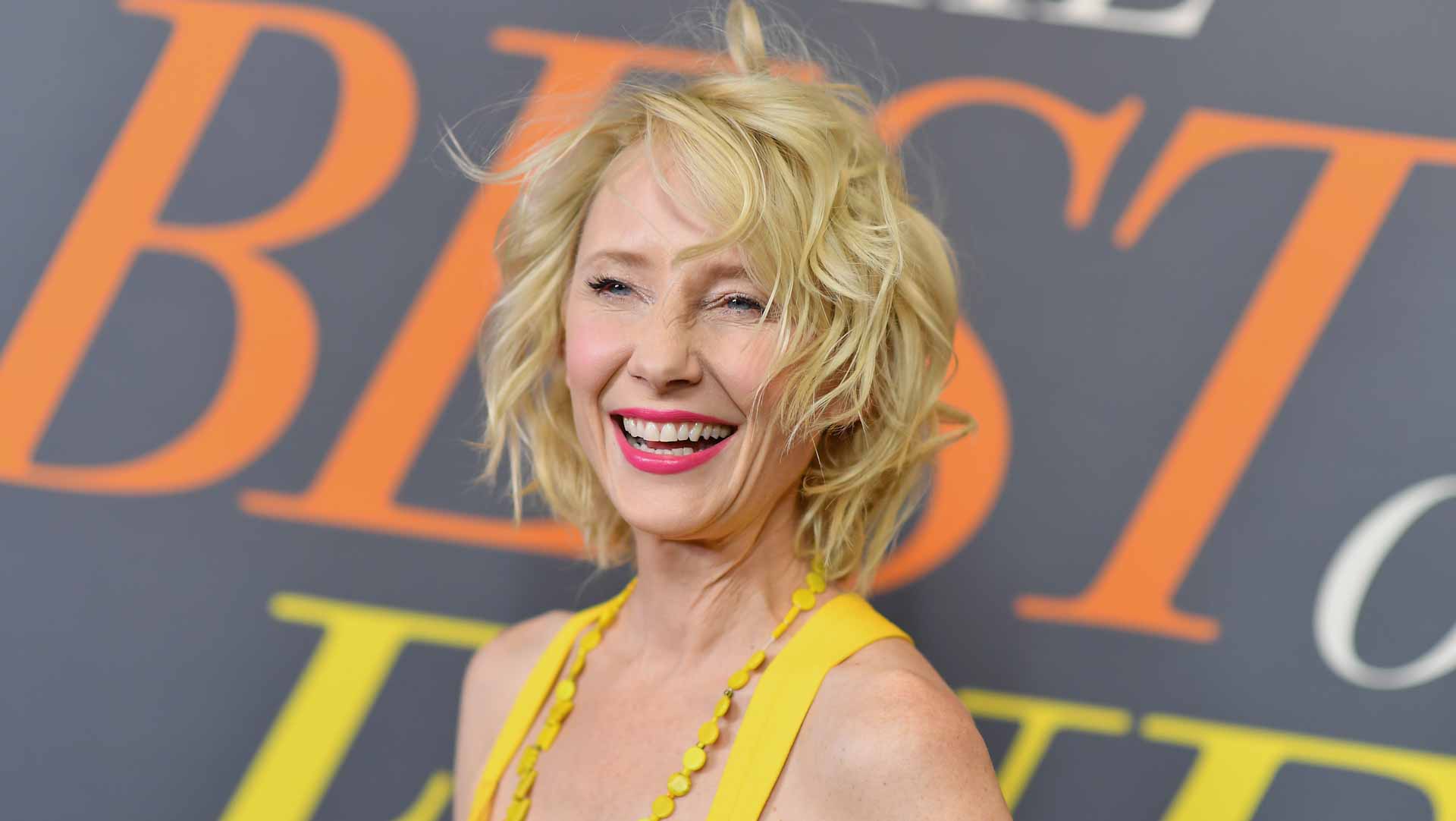 Image for the title: Anne Heche in coma since fiery car crash- spokesperson 