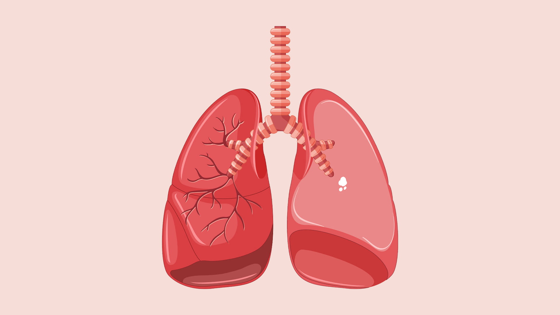 صورة بعنوان: أيها المدخن...ماذا تعرف عن الكشف المبكر لسرطان الرئة؟ 