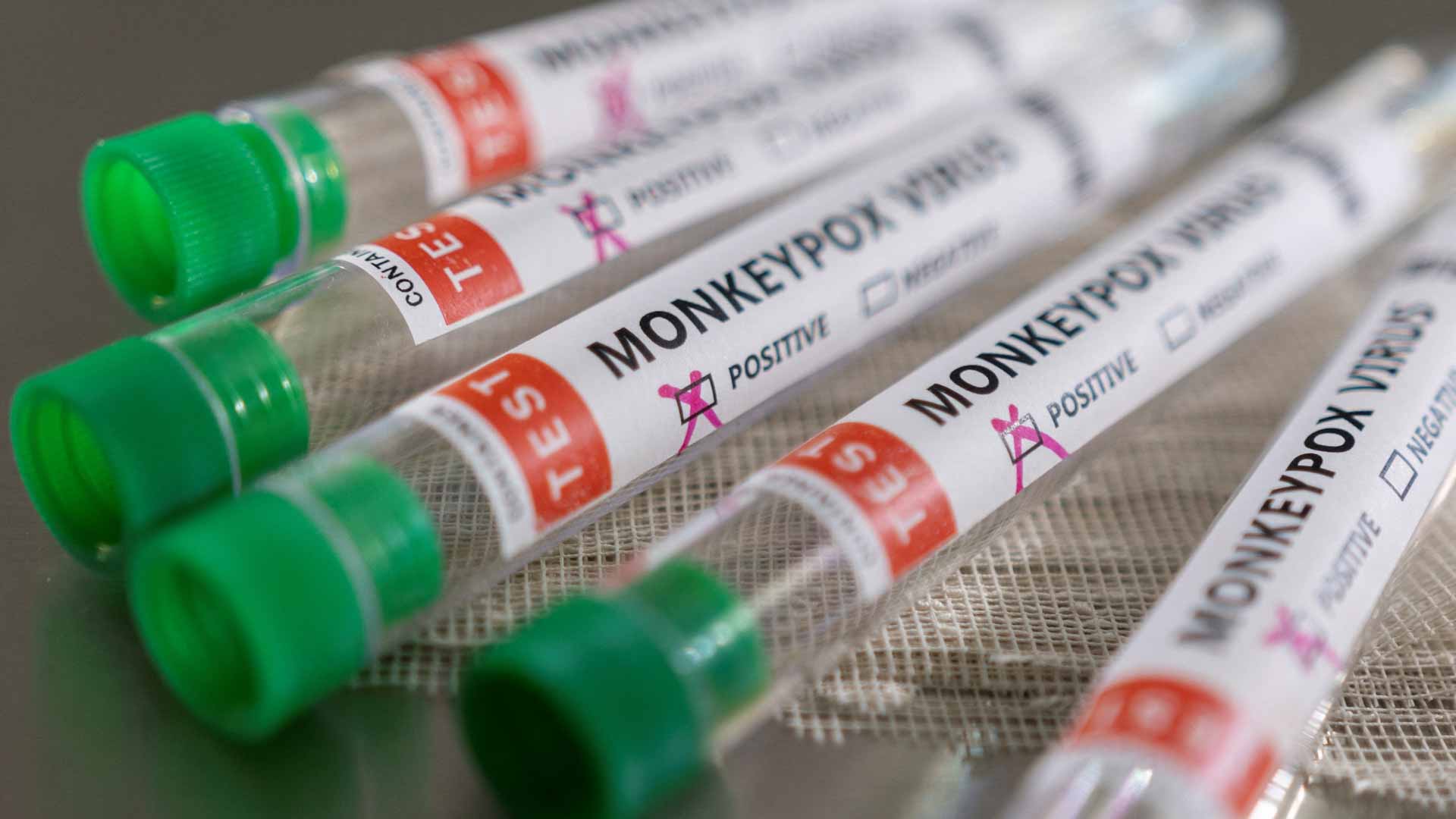 Image for the title: UK confirms local transmission of monkeypox 