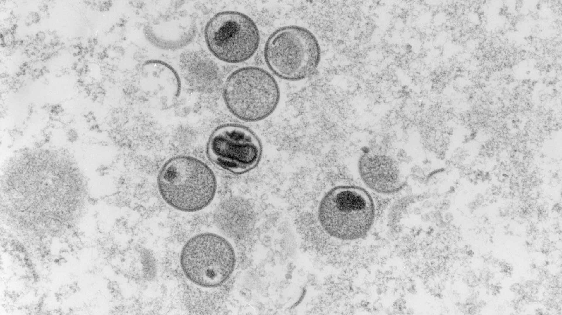Image for the title: French cases of monkeypox rise to five, versus three previously 