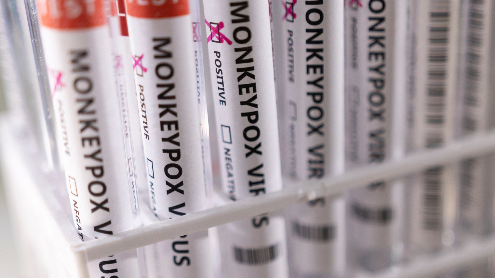 صورة بعنوان: الأرجنتين ترصد أول إصابتين بجدري القرود في أميركا اللاتينية 