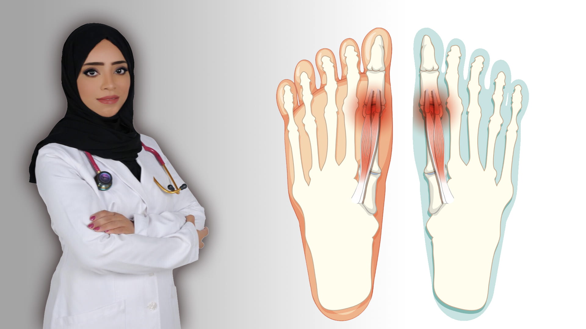 صورة بعنوان: داء الملوك 