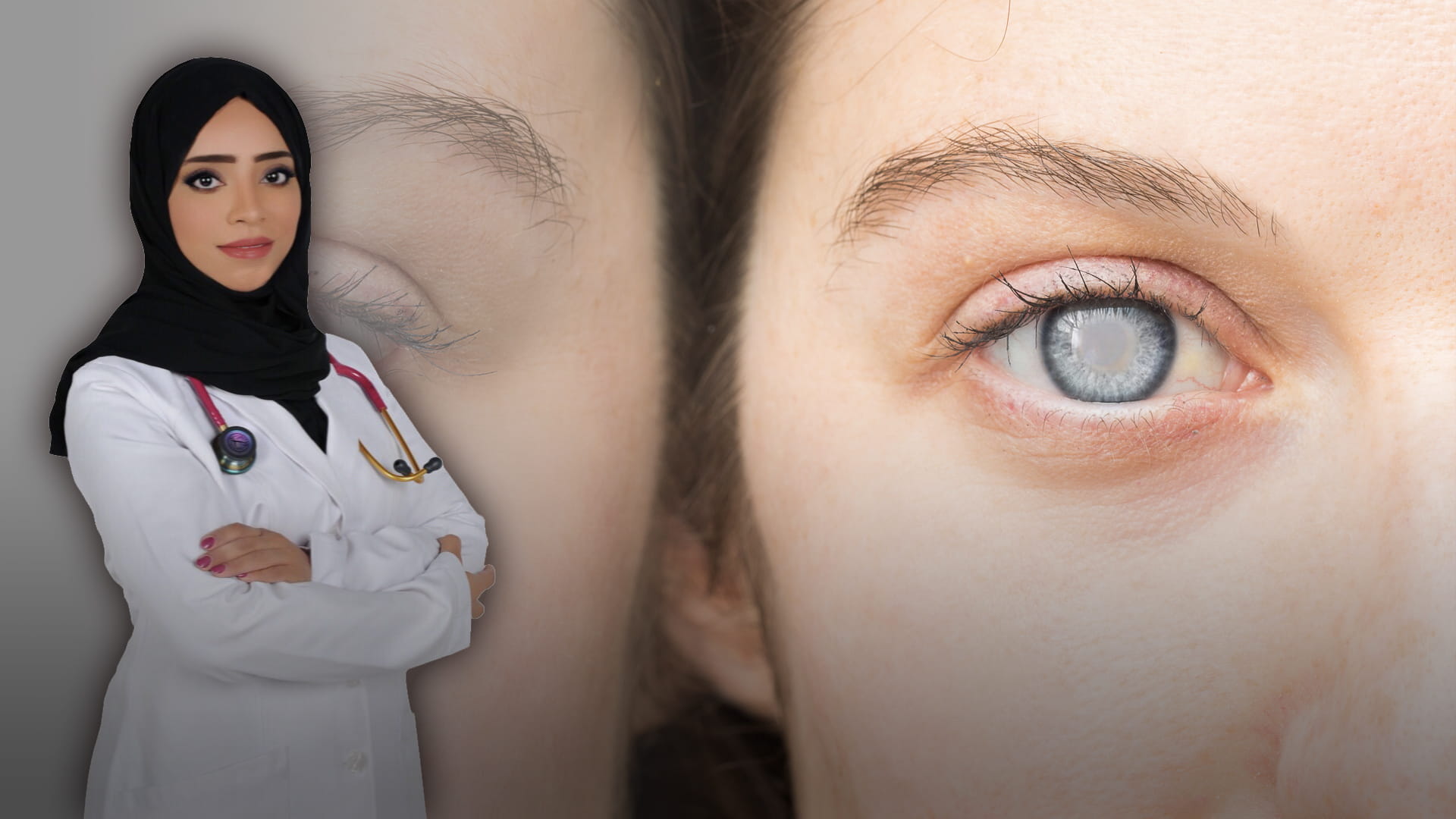 صورة بعنوان: الماء الأزرق 