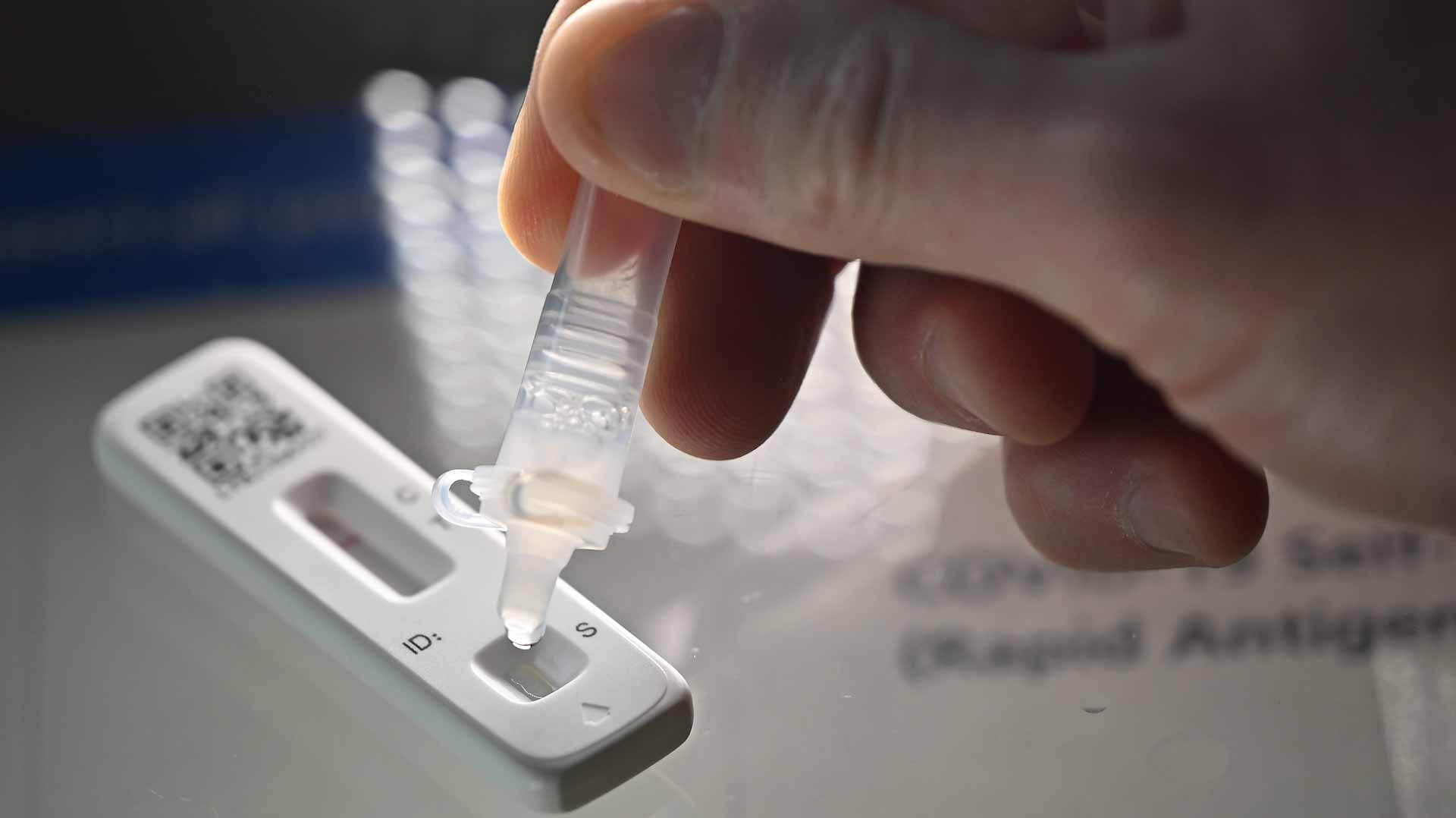 Image for the title: 1st genetic clue why some ppl. do not get sick from Covid 