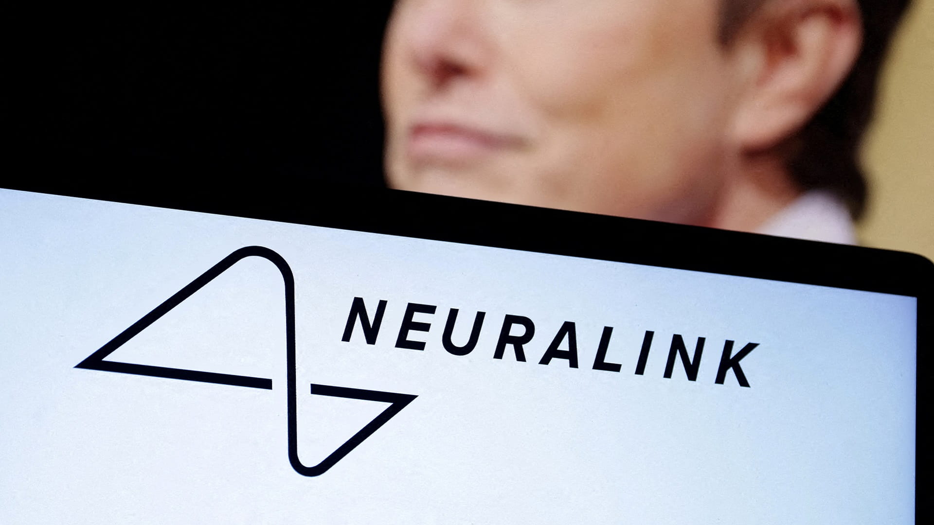 Image for the title: FDA approves Musk's Neuralink chip for human trials 