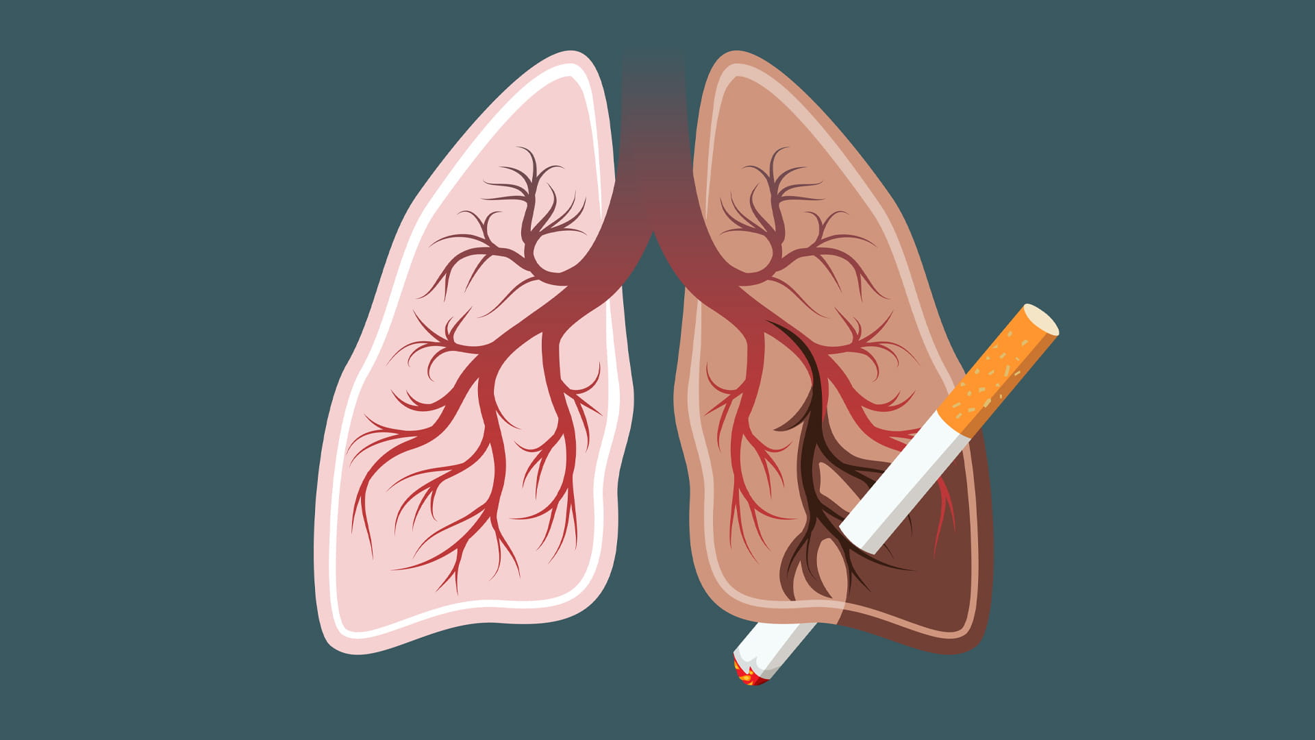 صورة بعنوان: في تحذير طبي..التدخين يثبط عمل بروتينات مسؤولة عن مكافحة السرطان 