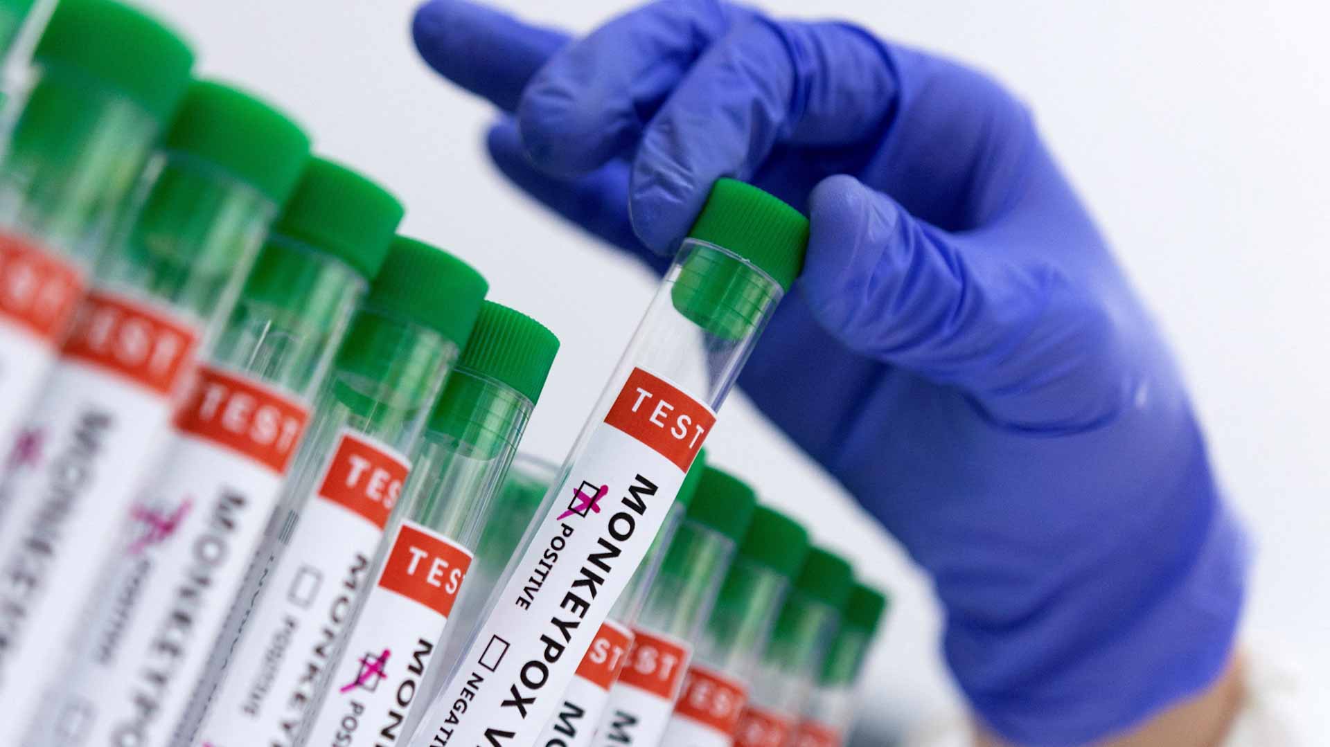 صورة بعنوان: تايلاند تكتشف أول إصابة بجدري القردة لأجنبي وافد من إفريقيا 