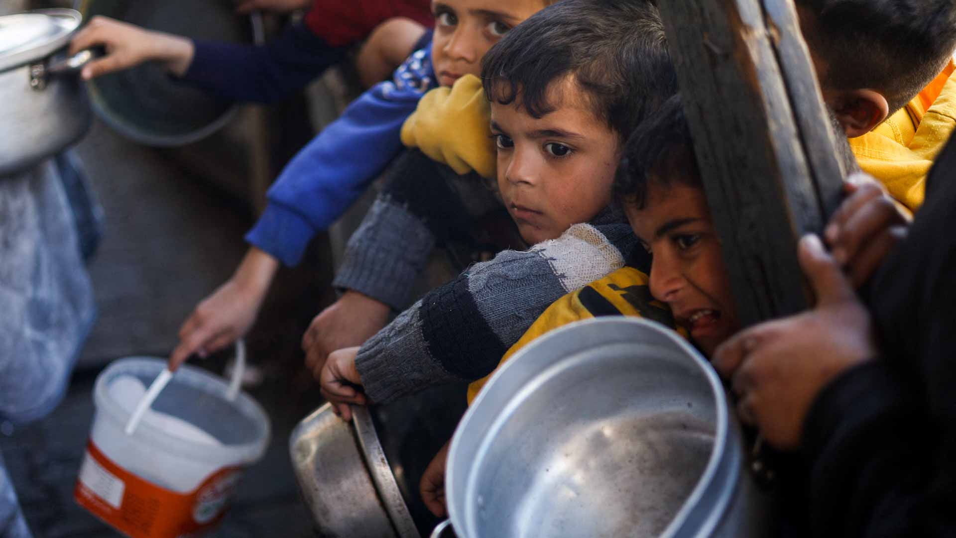 صورة بعنوان: الأونروا: طفل من بين 3 يعاني سوء تغذية حاد في غزة  