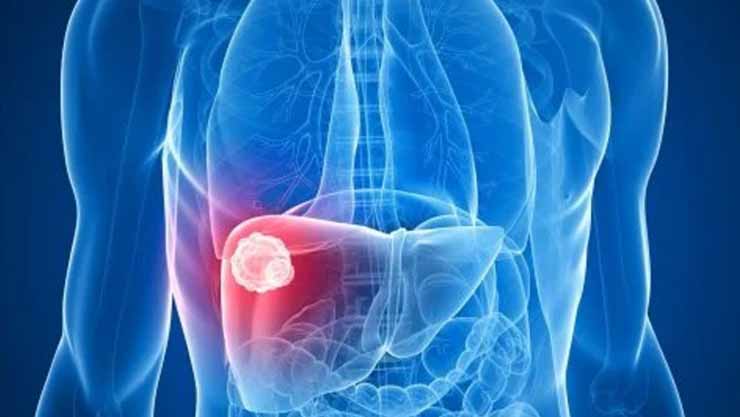 صورة بعنوان: بأمل جديد..تناول جرعة منخفضة من الأسبرين يومياً تقلل دهون الكبد 