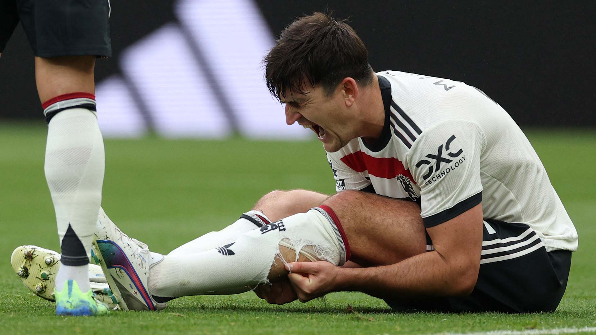 Manchester loses efforts of defender Maguire for several weeks 