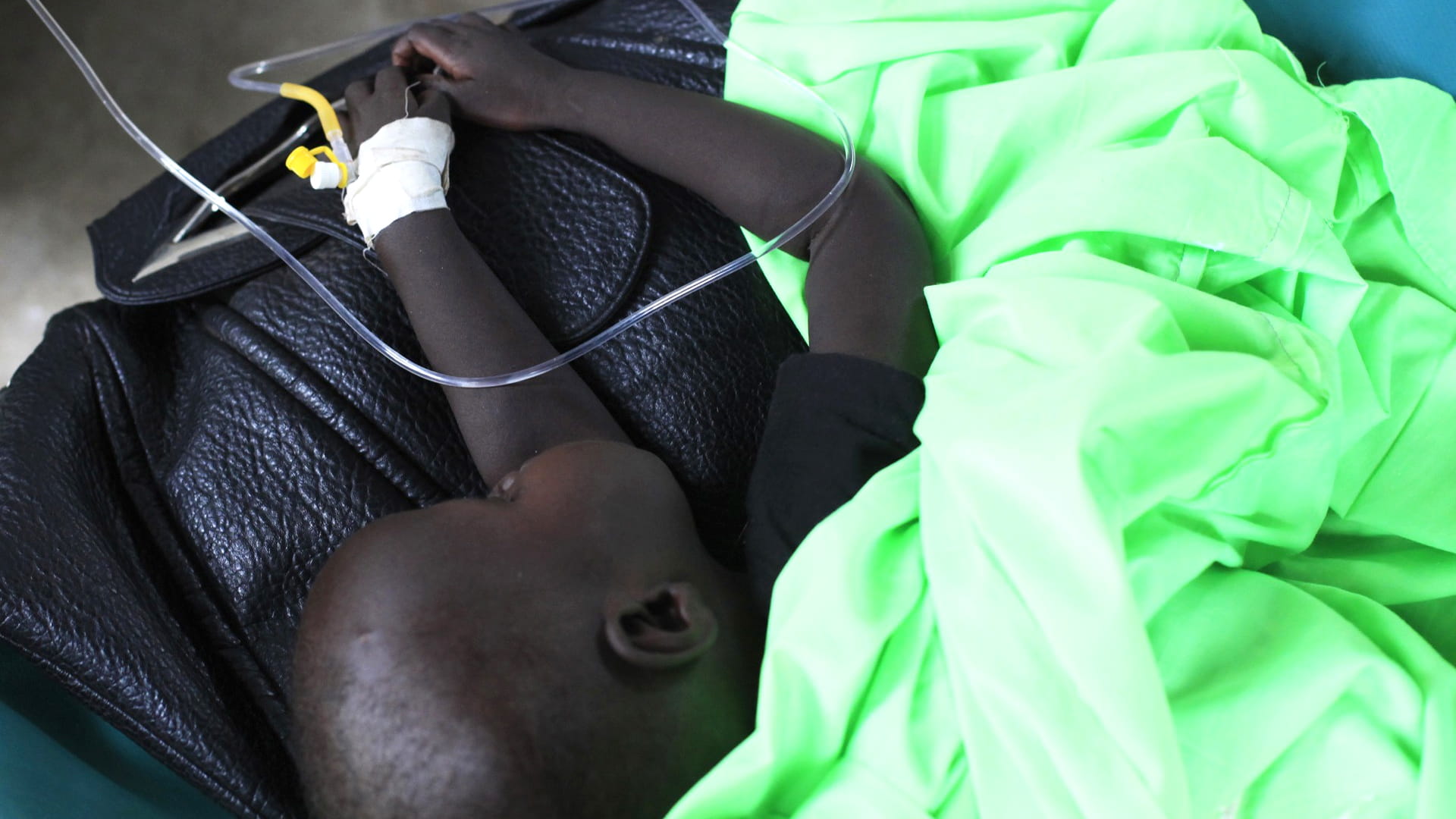 وفاة 8 مرضى بالكوليرا بجنوب السودان بعد تقليص المساعدات الأميركية 