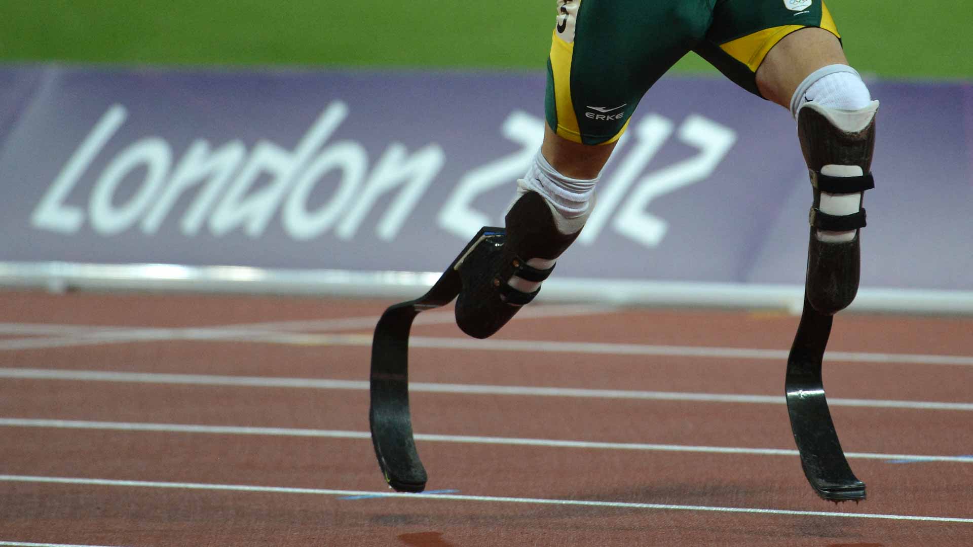 روسيا..ابتكار أطراف اصطناعية يمكن طباعتها على طابعة ثلاثية الأبعاد 