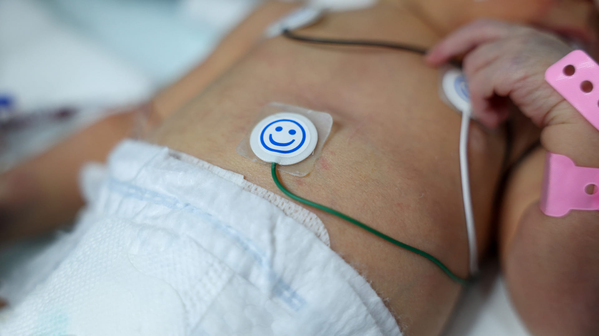 في اعتراف طبي.. الذكاء الاصطناعي يحسن رصد مشاكل القلب عند الأجنة 