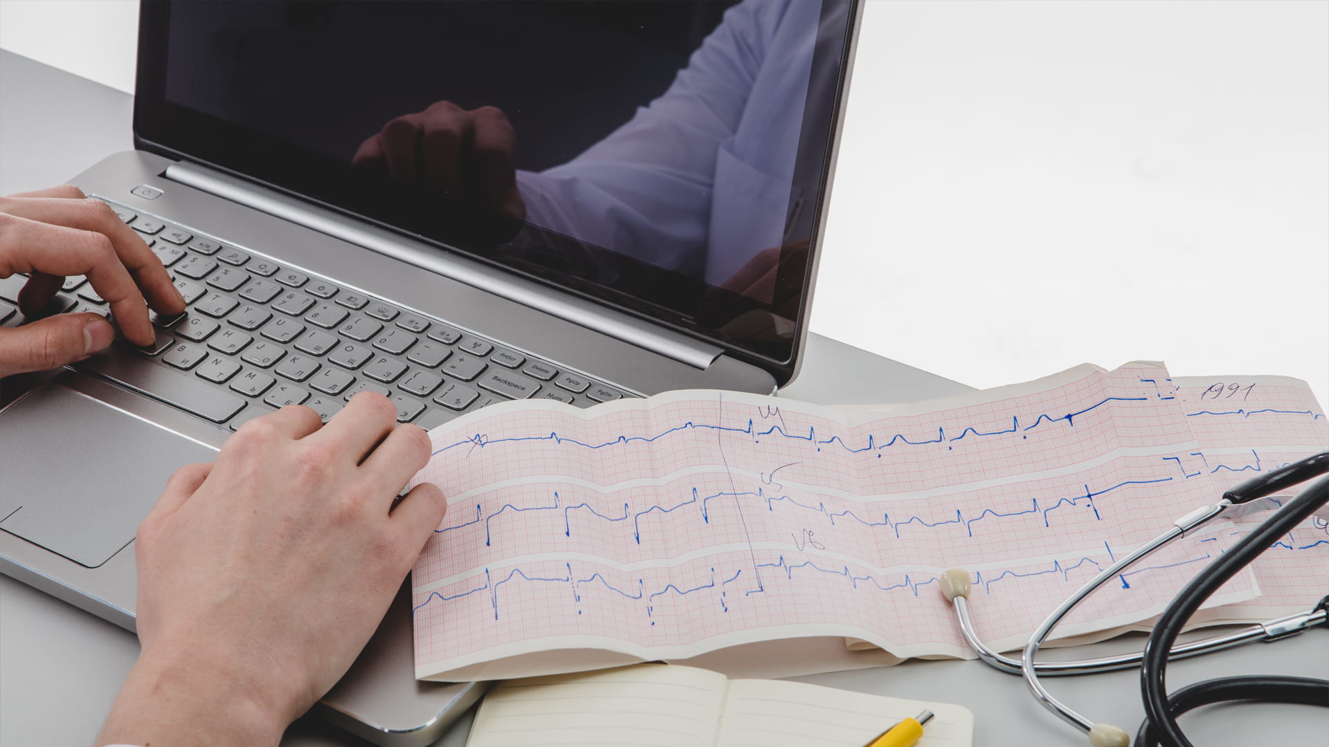 الذكاء الاصطناعي أفضل من البشر في تحليل بيانات أجهزة مراقبة القلب 