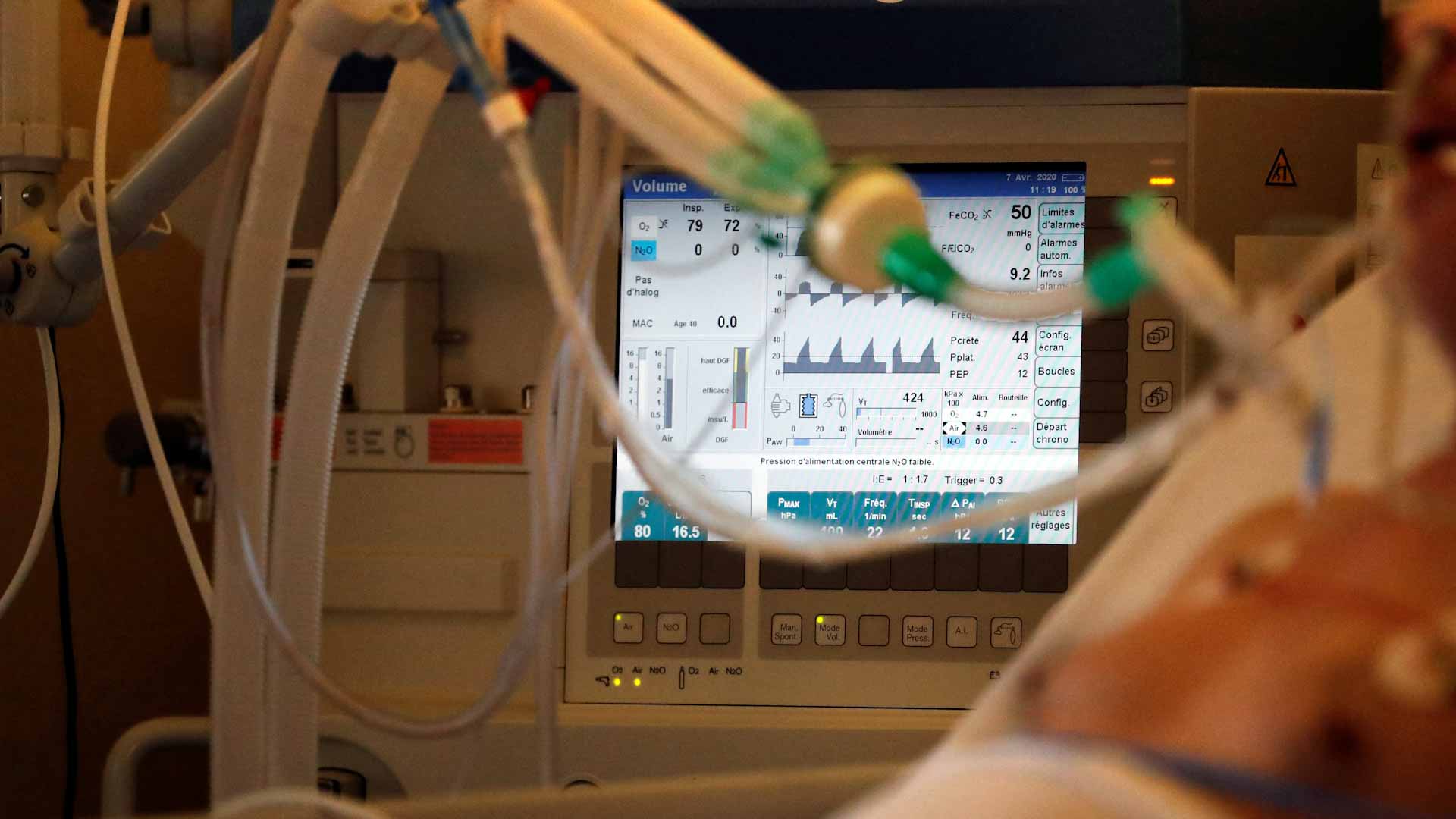 بابتكار طبي جديد.. شركة روسية تطلق جهازاً محمولاً للتنفس الاصطناعي 