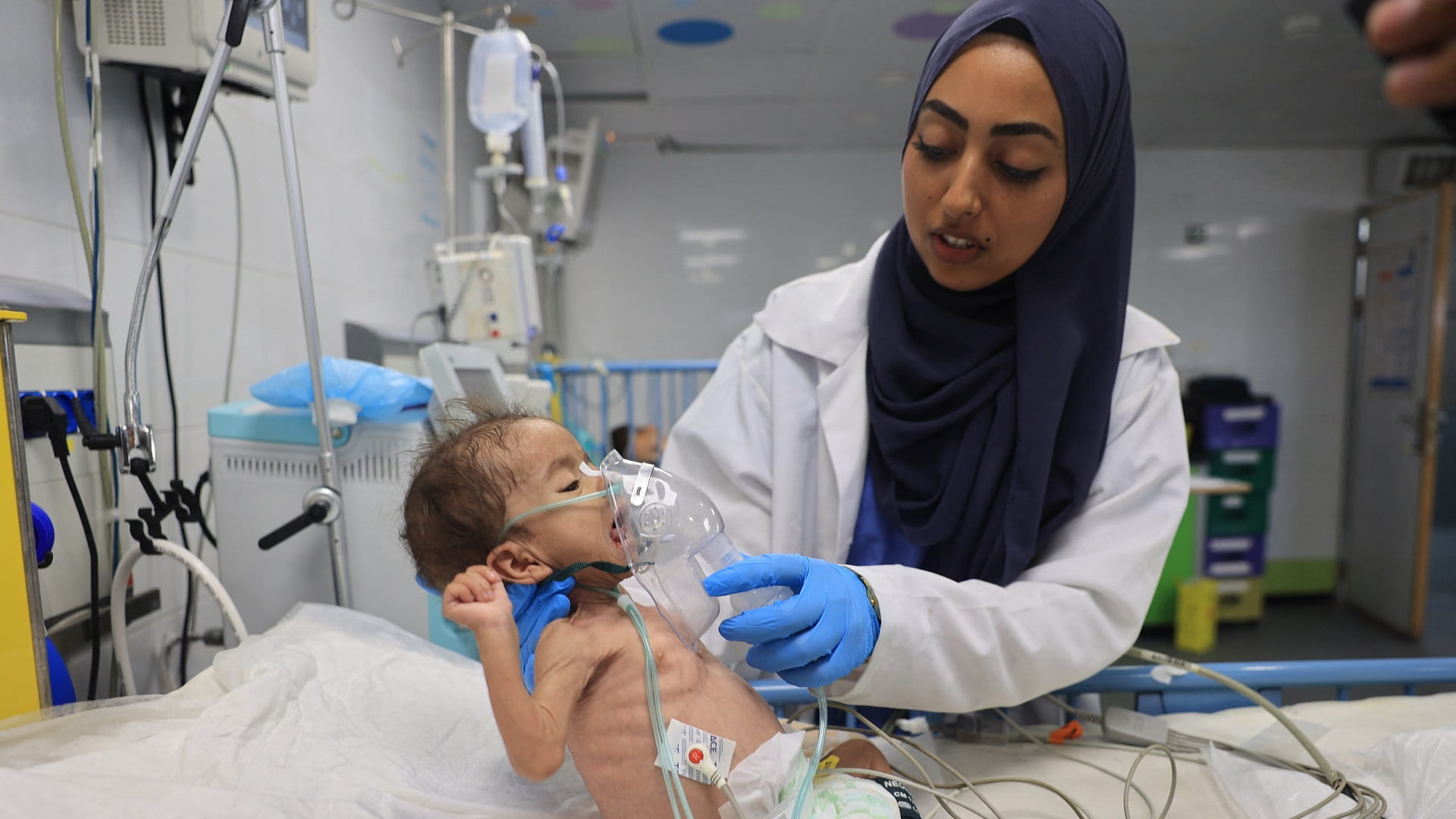 100 ألف طفل في غزة يواجهون خطر الموت الجماعي بسبب انعدام الحليب 