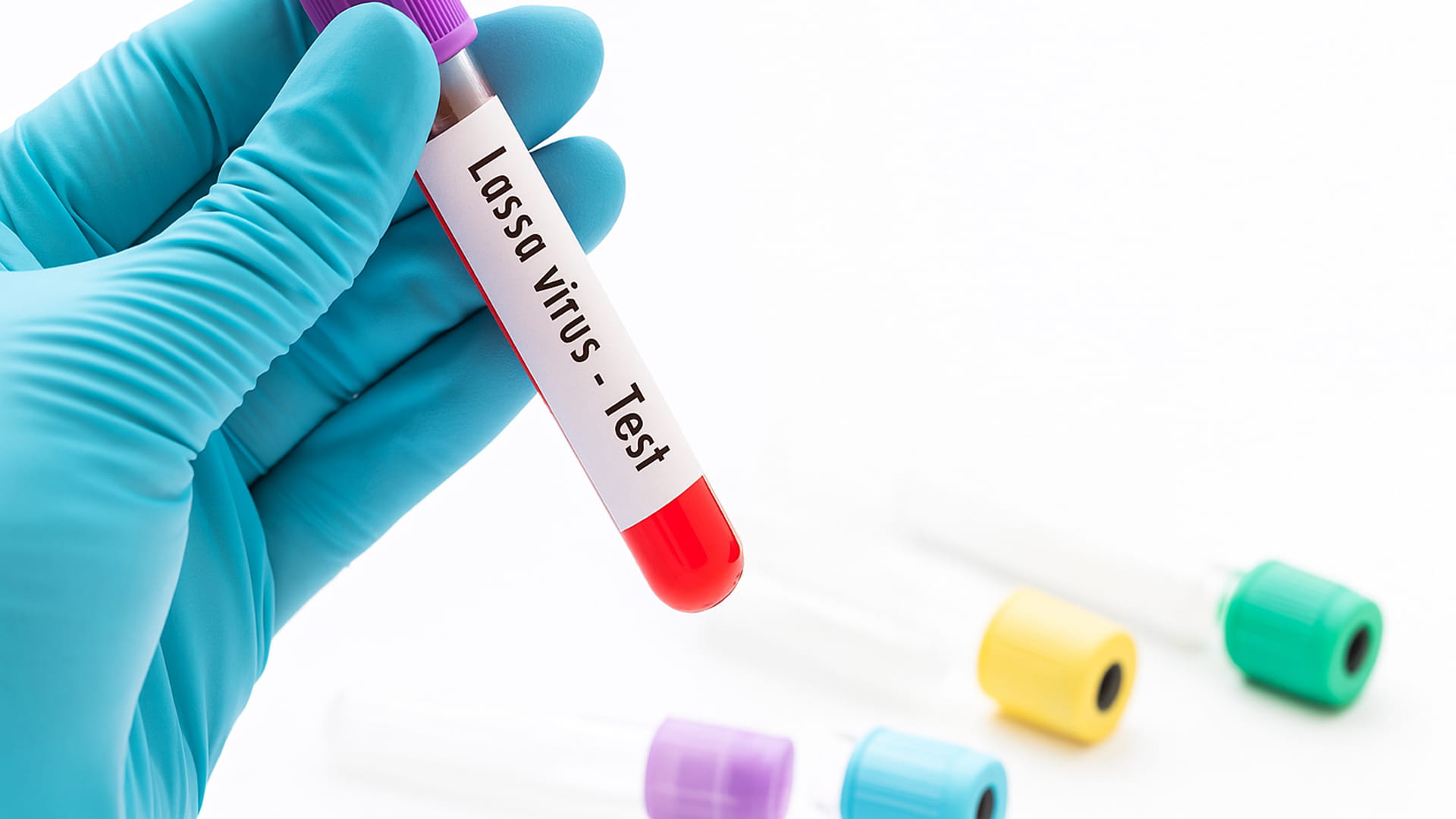 علماء نيجيريون يطورون لقاحاً جديداً ضد حمّى "لاسا" 