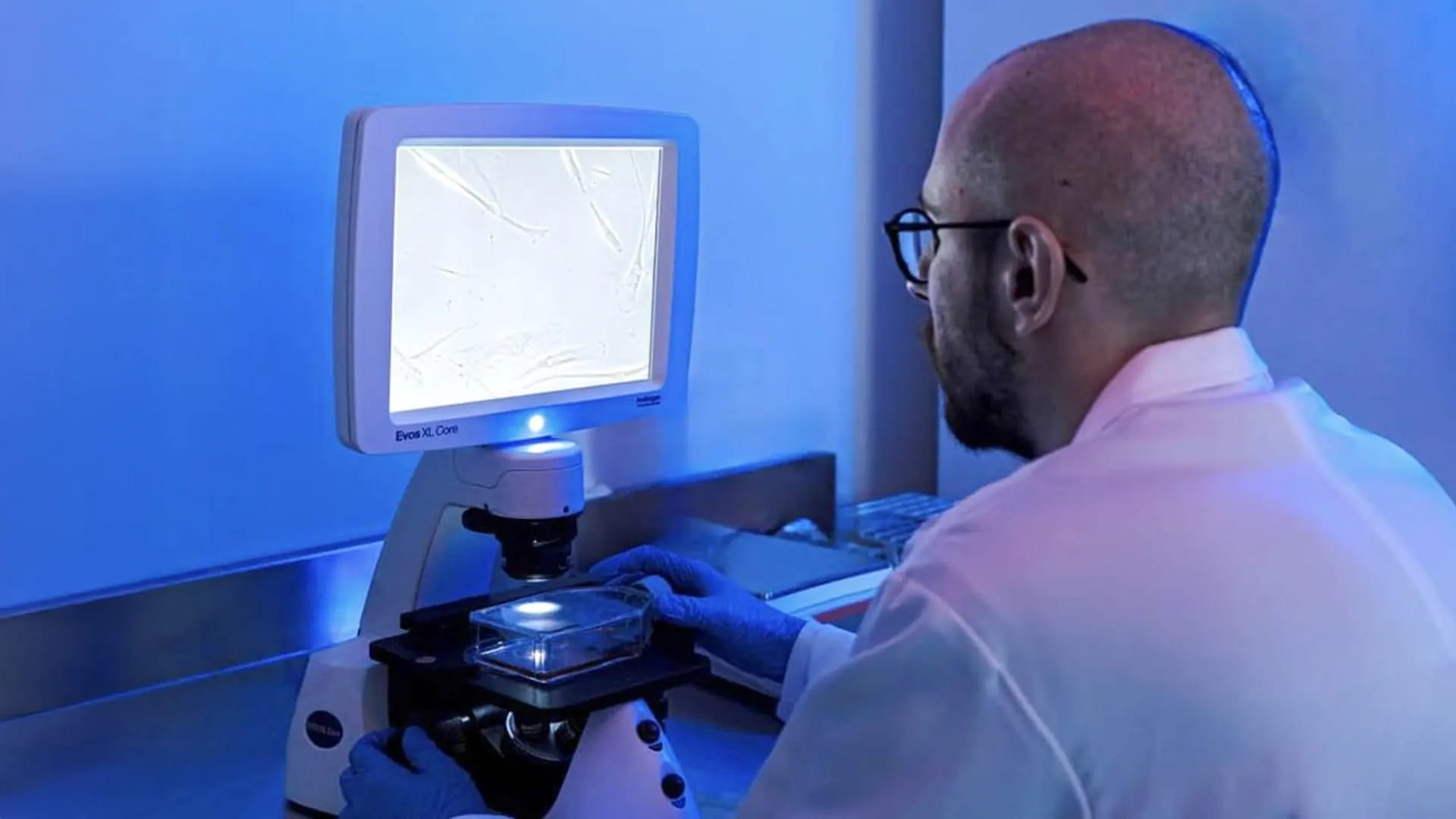 علاج الخلايا الجذعية.. أمل جديد لتحسين إصابات النخاع الشوكي 