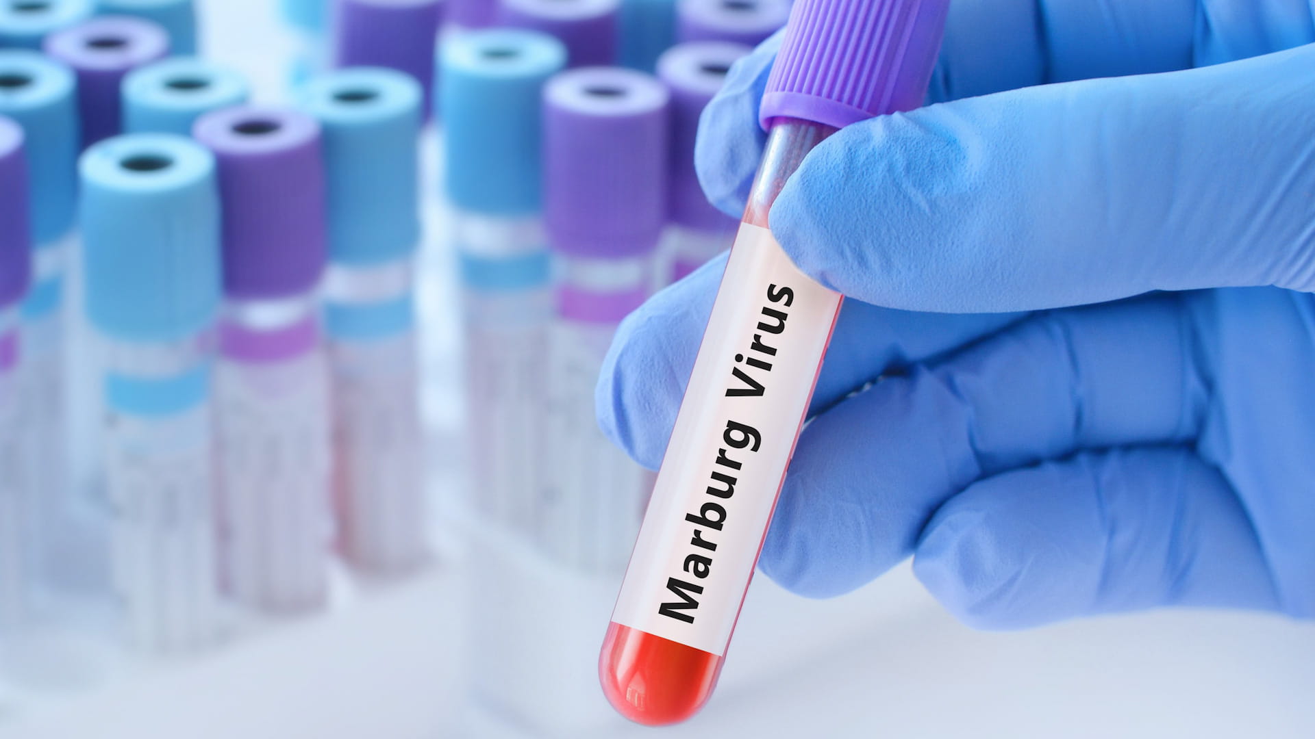  لأول مرة.. إثيوبيا تعلن تفشي وباء "ماربورغ" بجنوب البلاد