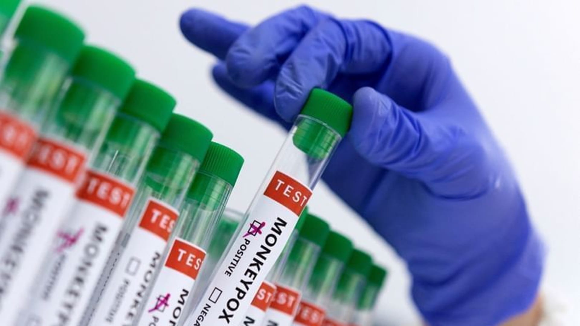 DR Congo declares end of two-year monkeypox outbreak