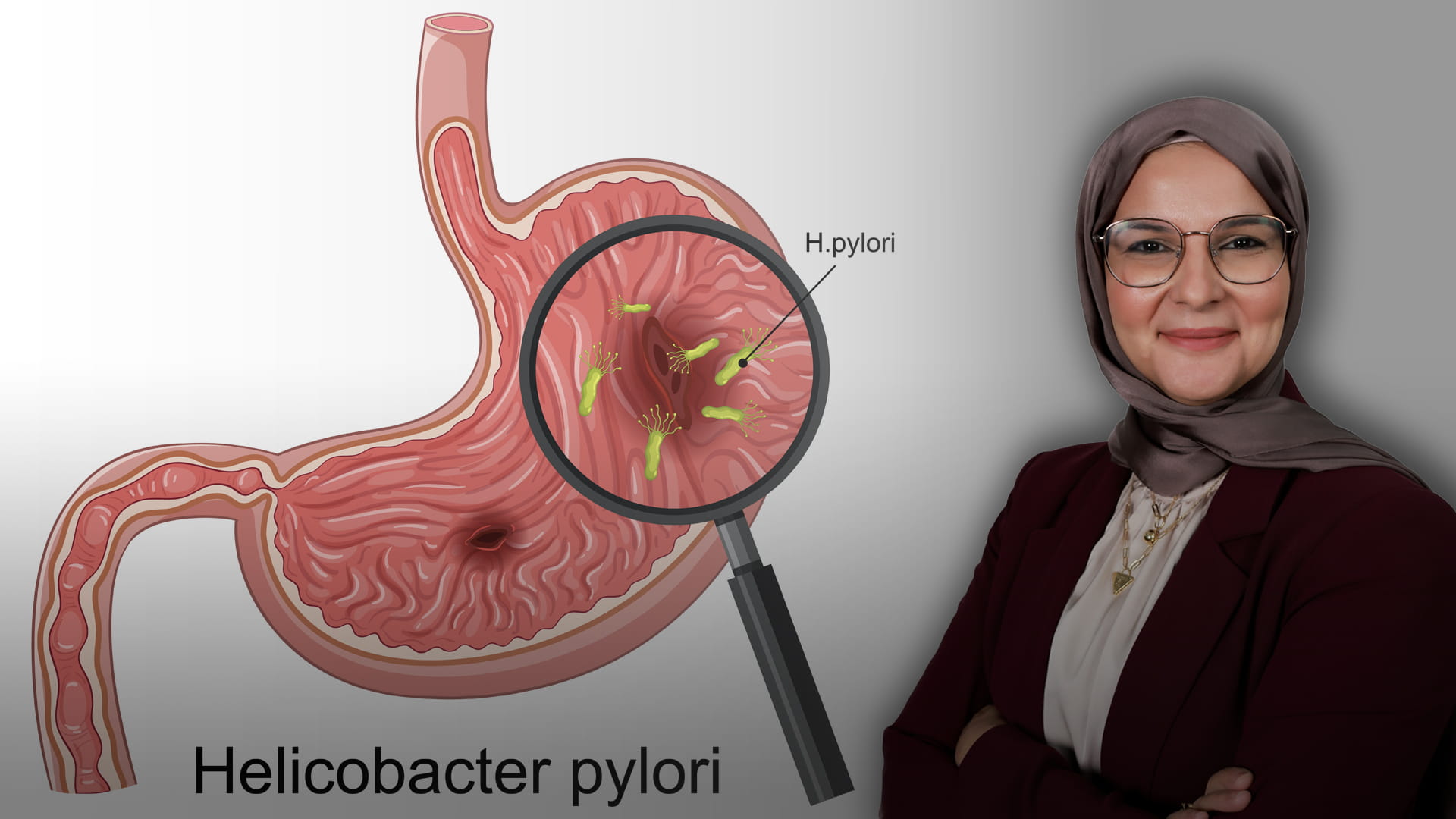 الملوية البوابية.. تحدٍ صحي يستدعي الوعي والبحث