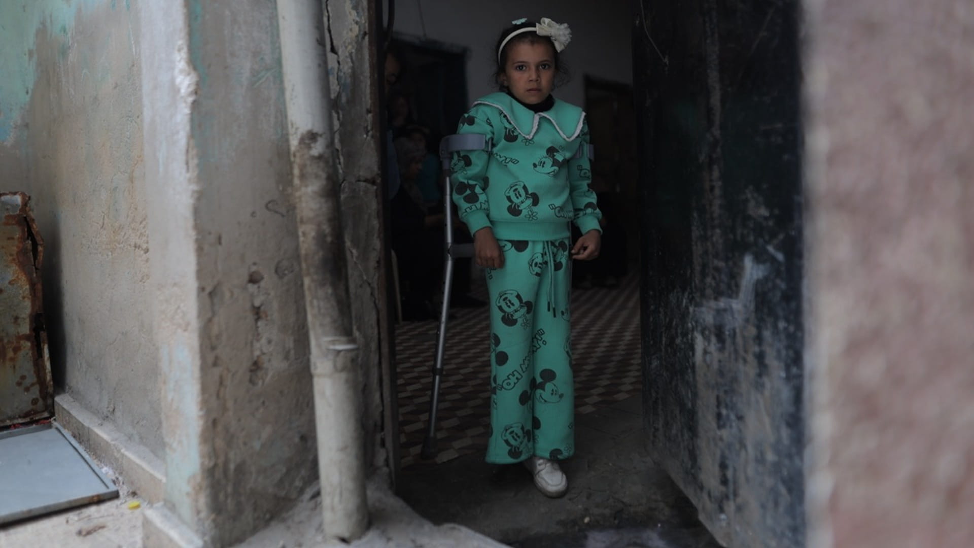 TBHF provides treatment for 1,000 amputee children in Gaza 