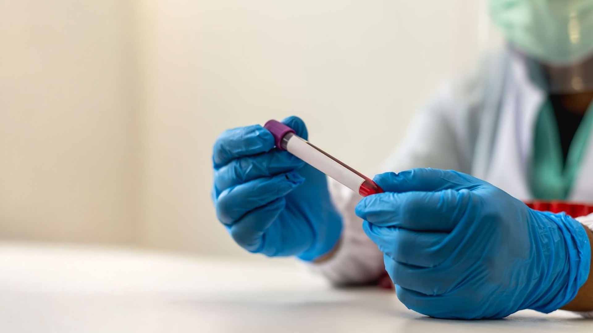 علماء يبتكرون مركب فطري واعد يفتح آفاقاً جديدة لعلاج السرطان 